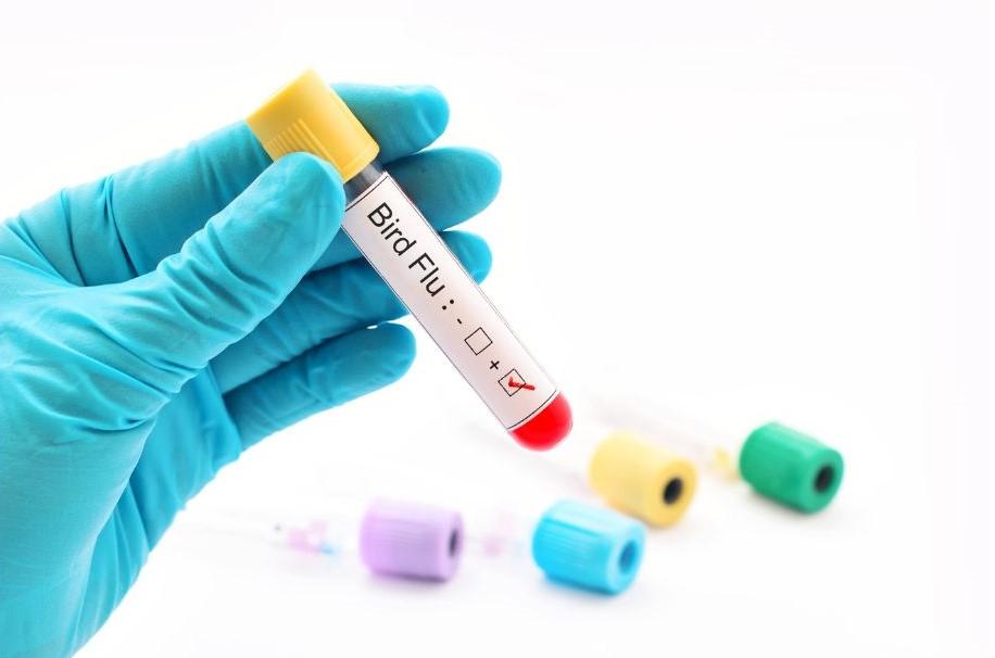 Imagen Medidas preventivas para proteger la salud pública y animal y evitar la propagación de la gripe aviar